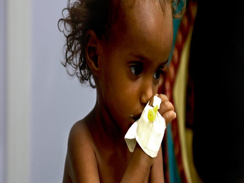 ©UNICEF/Almahbashi Millones de niños en Yemen están amenazados por la malnutrición y la falta de servicios básicos. Una situación causada por la guerra ©UNICEF/Almahbashi Millones de niños en Yemen están amenazados por la malnutrición y la falta de servicios básicos. Una situación causada por la guerra